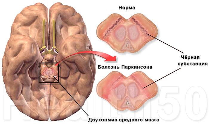 черная субстанция