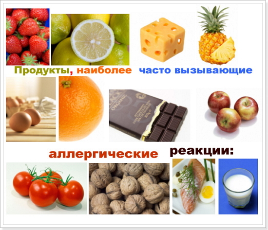 пищевая аллергия