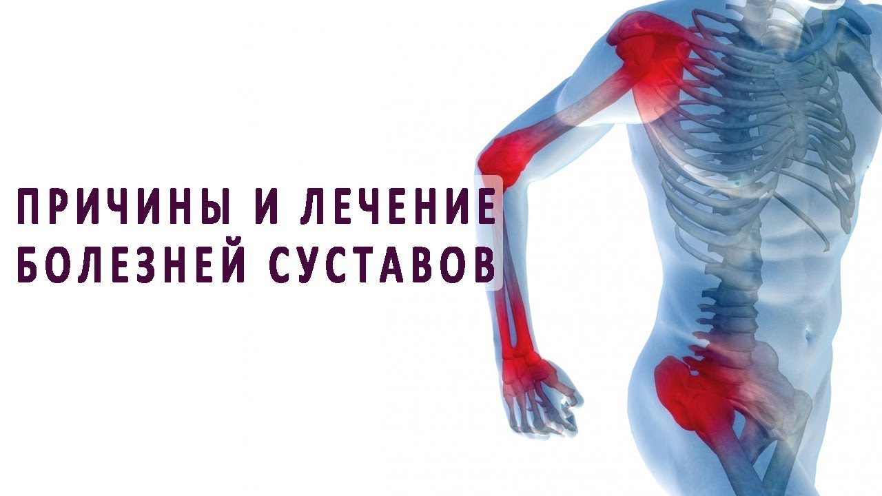 причины